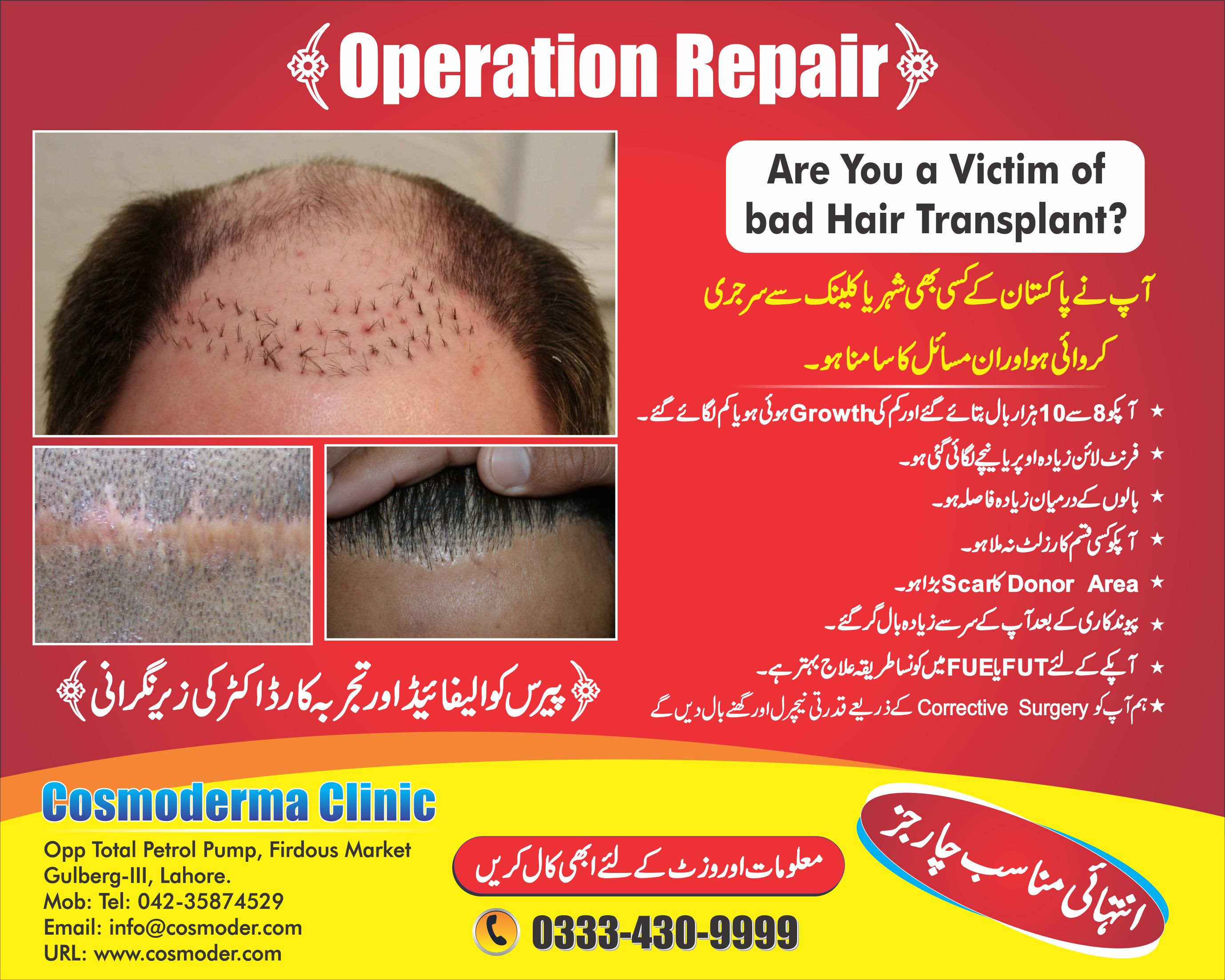 Hair Transplant discount-Off in Lahore | Cosmoderma Clinic | Free Advice
